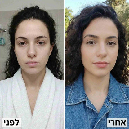 המבוסס על PDRN DNA של סלמון בריכוז עוצמתי