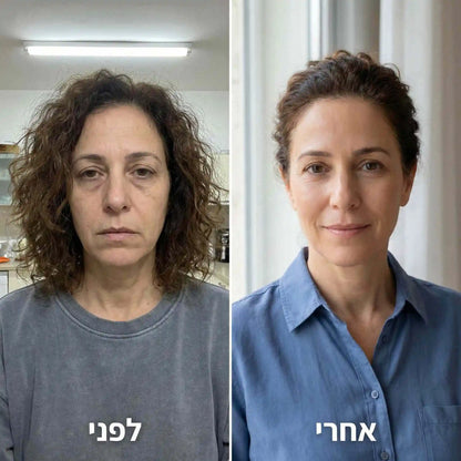 המבוסס על PDRN DNA של סלמון בריכוז עוצמתי