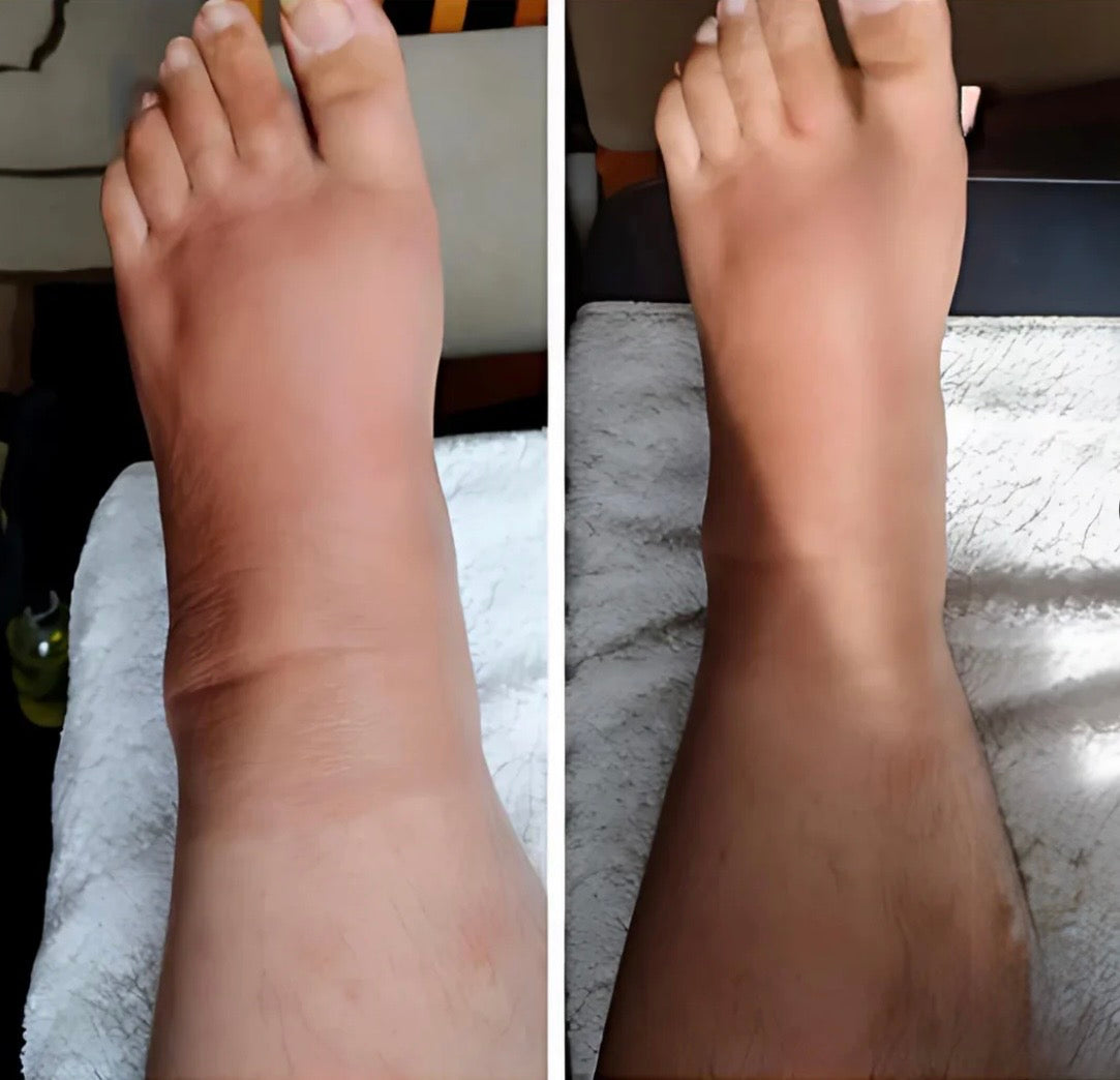 ™️SleeveLife - שרוול לטיפול והקלה מהירה בכאבים