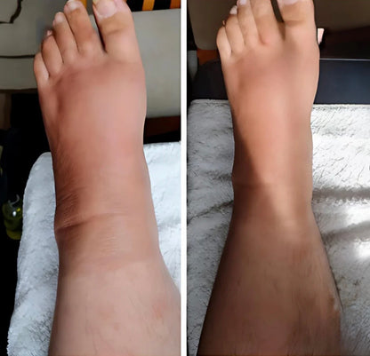 ™️SleeveLife - שרוול לטיפול והקלה מהירה בכאבים